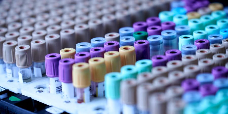 viles of tested liquids