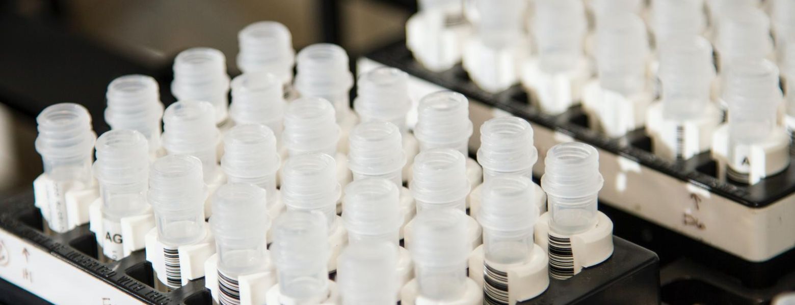 drug test vials, indoors