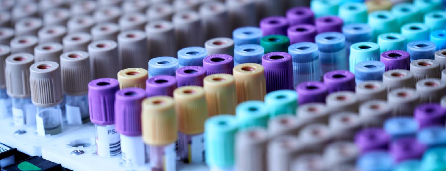 viles of tested liquids